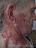 herpes_zoster_1.jpg
