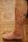 kaposis_sarcoma_1.jpg