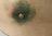 Tick