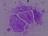 trichomonas_vaginalis.jpg