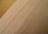 urticaria, urticarial dermographism