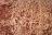 Psoriasis pustulosa von Zumbush