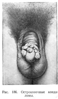���������� ������� (syphilis papulosa)