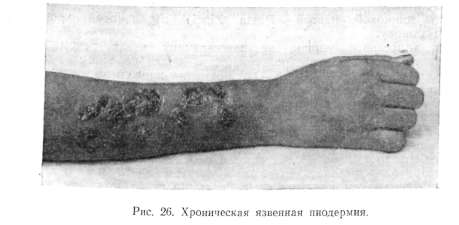 ����������� �������� ���������, pyodermia